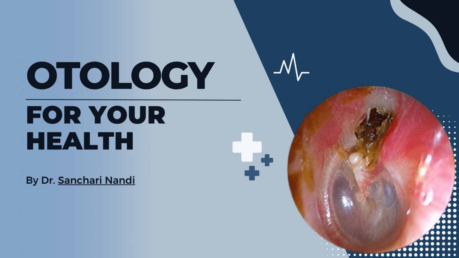 Otology Questions with Answers – ent-osce.com